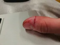 Image attachment thumbnail